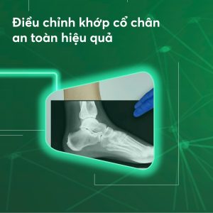 ĐẾ CHỈNH HÌNH BÀN CHÂN BẸT 3D