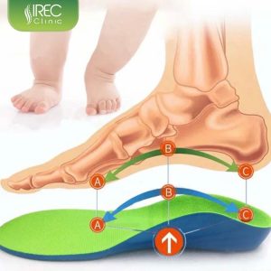 Sử dụng Đế chỉnh hình 3D 